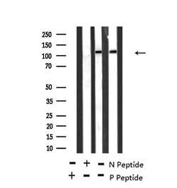 Invitrogen Phospho-TEK (Ser1119) Polyclonal Antibody 100 &mu;L; Unconjugated:Antibodies,