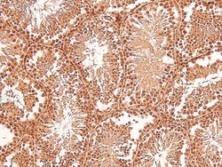 Invitrogen Phospho-TTK (Thr676) Polyclonal Antibody 100 &mu;L; Unconjugated:Antibodies,