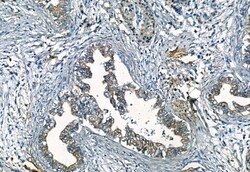 Invitrogen Phospho-FRS2 (Tyr196) Polyclonal Antibody 100 μL; Unconjugated:Antibodies,