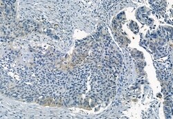 Invitrogen Phospho-FRS2 (Tyr196) Polyclonal Antibody 100 μL; Unconjugated:Antibodies,
