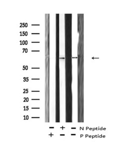 Invitrogen Phospho-FRS2 (Tyr196) Polyclonal Antibody 100 μL; Unconjugated:Antibodies,