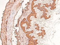 Invitrogen Phospho-FRS2 (Tyr196) Polyclonal Antibody 100 μL; Unconjugated:Antibodies,