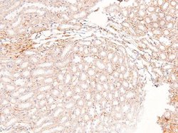 Invitrogen Phospho-FRS2 (Tyr196) Polyclonal Antibody 100 μL; Unconjugated:Antibodies,