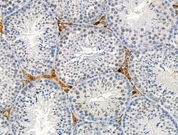 Invitrogen Phospho-Androgen Receptor (Ser83) Polyclonal Antibody 100 μL;