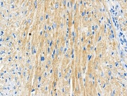 Invitrogen Phospho-Androgen Receptor (Ser83) Polyclonal Antibody 100 μL;