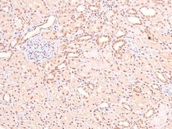 Invitrogen Phospho-LAT (Tyr161) Polyclonal Antibody 100 &mu;L | Buy Online | Invitrogen&trade; | Fisher Scientific