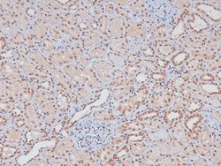Invitrogen Phospho-LAT (Tyr161) Polyclonal Antibody 100 &mu;L | Buy Online | Invitrogen&trade; | Fisher Scientific