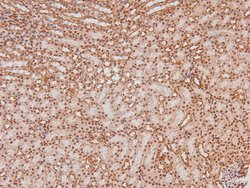 Invitrogen Phospho-LAT (Tyr161) Polyclonal Antibody 100 &mu;L | Buy Online | Invitrogen&trade; | Fisher Scientific