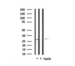 Invitrogen Phospho-LAT (Tyr161) Polyclonal Antibody 100 &mu;L | Buy Online | Invitrogen&trade; | Fisher Scientific