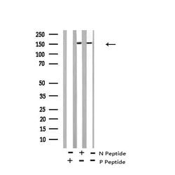 Invitrogen Phospho-RET (Tyr1015) Polyclonal Antibody 100 &mu;L; Unconjugated:Antibodies,