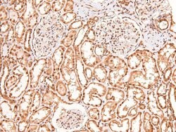 Invitrogen Phospho-BRCA1 (Ser1387) Polyclonal Antibody 100 &mu;L; Unconjugated:Antibodies,