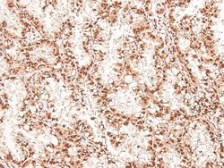 Invitrogen Phospho-eIF2b epsilon (Ser540) Polyclonal Antibody 100 &mu;L | Buy Online | Invitrogen&trade; | Fisher Scientific