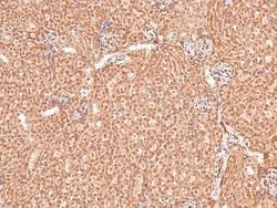 Invitrogen Phospho-eIF2b epsilon (Ser540) Polyclonal Antibody 100 &mu;L | Buy Online | Invitrogen&trade; | Fisher Scientific