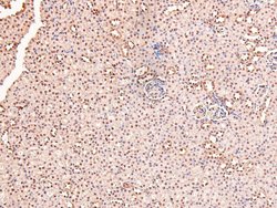 Phospho-RARA/RARB (Ser96) Polyclonal Antibody, Invitrogen 100 &mu;L; Unconjugated:Antibodies,