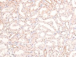 Phospho-RARA/RARB (Ser96) Polyclonal Antibody, Invitrogen 100 &mu;L; Unconjugated:Antibodies,