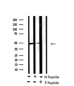 Phospho-RARA/RARB (Ser96) Polyclonal Antibody, Invitrogen 100 &mu;L; Unconjugated:Antibodies,
