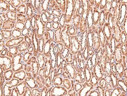 Invitrogen Phospho-LRP1 (Ser4520) Polyclonal Antibody 100 &mu;L | Buy Online | Invitrogen&trade; | Fisher Scientific