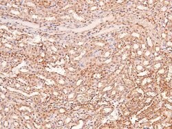 Invitrogen Phospho-LRP1 (Ser4520) Polyclonal Antibody 100 &mu;L | Buy Online | Invitrogen&trade; | Fisher Scientific