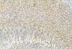 Invitrogen Phospho-ERK1/ERK2 (Thr202, Tyr204, Thr185, Tyr187) Polyclonal