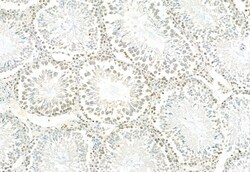 Invitrogen Phospho-ERK1/ERK2 (Thr202, Tyr204, Thr185, Tyr187) Polyclonal