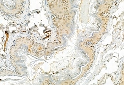 Invitrogen Phospho-ERK1/ERK2 (Thr202, Tyr204, Thr185, Tyr187) Polyclonal