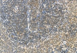 Invitrogen Phospho-ERK1/ERK2 (Thr202, Tyr204, Thr185, Tyr187) Polyclonal