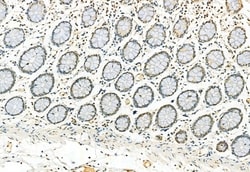 Invitrogen Phospho-ERK1/ERK2 (Thr202, Tyr204, Thr185, Tyr187) Polyclonal