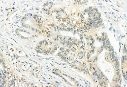 Invitrogen Phospho-ERK1/ERK2 (Thr202, Tyr204, Thr185, Tyr187) Polyclonal