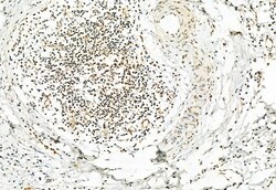 Invitrogen Phospho-ERK1/ERK2 (Thr202, Tyr204, Thr185, Tyr187) Polyclonal