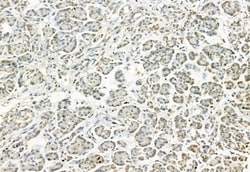 Invitrogen Phospho-ERK1/ERK2 (Thr202, Tyr204, Thr185, Tyr187) Polyclonal