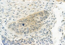 Invitrogen Phospho-ERK1/ERK2 (Thr202, Tyr204, Thr185, Tyr187) Polyclonal