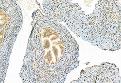 Invitrogen Phospho-ERK1/ERK2 (Thr202, Tyr204, Thr185, Tyr187) Polyclonal