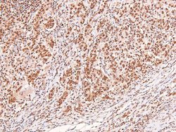 Invitrogen Phospho-ERK1/ERK2 (Thr202, Tyr204, Thr185, Tyr187) Polyclonal