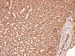 Invitrogen Phospho-ERK1/ERK2 (Thr202, Tyr204, Thr185, Tyr187) Polyclonal
