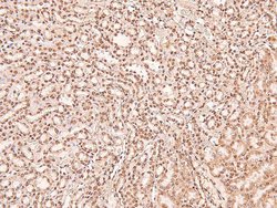 Invitrogen Phospho-ERK1/ERK2 (Thr202, Tyr204, Thr185, Tyr187) Polyclonal