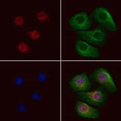 Invitrogen Phospho-Trf2 (Thr188) Polyclonal Antibody 100 &mu;L; Unconjugated:Antibodies,