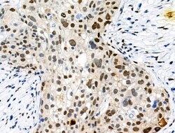 Invitrogen Phospho-Trf2 (Thr188) Polyclonal Antibody 100 &mu;L; Unconjugated:Antibodies,