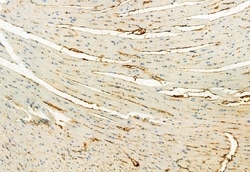 Invitrogen Phospho-FGFR Pan (Tyr653, Tyr654) Polyclonal Antibody 100 μL;