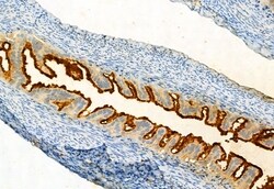 Invitrogen Phospho-FGFR Pan (Tyr653, Tyr654) Polyclonal Antibody 100 μL;