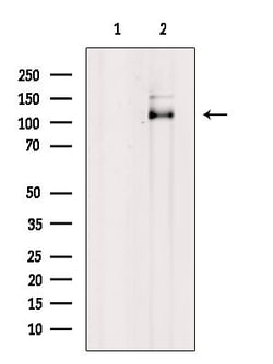 Invitrogen Phospho-Androgen Receptor (Tyr269) Polyclonal Antibody 100 &mu;L;
