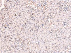 Invitrogen Phospho-Androgen Receptor (Tyr269) Polyclonal Antibody 100 &mu;L;