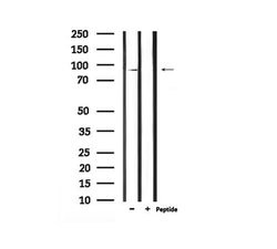 Invitrogen Phospho-Leptin Receptor (Tyr986) Polyclonal Antibody 100 &mu;L;
