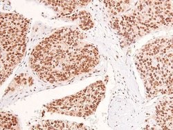 Invitrogen Phospho-EphB1/EphB3/EphB4 (Tyr778, Tyr792, Tyr774) Polyclonal