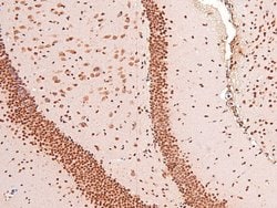 Invitrogen Phospho-EphB1/EphB3/EphB4 (Tyr778, Tyr792, Tyr774) Polyclonal