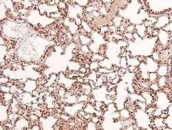 Invitrogen Phospho-EphB1/EphB3/EphB4 (Tyr778, Tyr792, Tyr774) Polyclonal