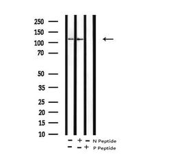 Invitrogen Phospho-EphB1/EphB3/EphB4 (Tyr778, Tyr792, Tyr774) Polyclonal