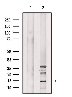 Phospho-Histone H2A (Ser2) Polyclonal Antibody, Invitrogen 100 &mu;L; Unconjugated:Antibodies,