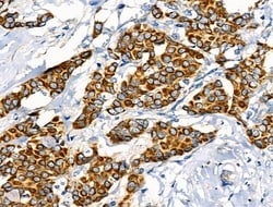 Invitrogen Phospho-Leptin Receptor (Tyr1141) Polyclonal Antibody 100 μL;