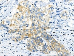 Invitrogen Phospho-Leptin Receptor (Tyr1141) Polyclonal Antibody 100 μL;