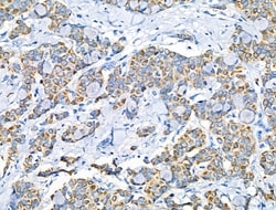 Invitrogen Phospho-Leptin Receptor (Tyr1141) Polyclonal Antibody 100 μL;